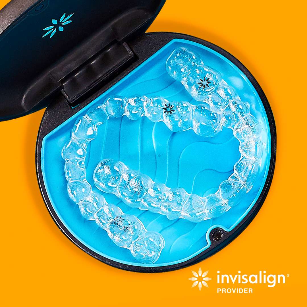 Invisalign – Gouttières perdues ou endommagées